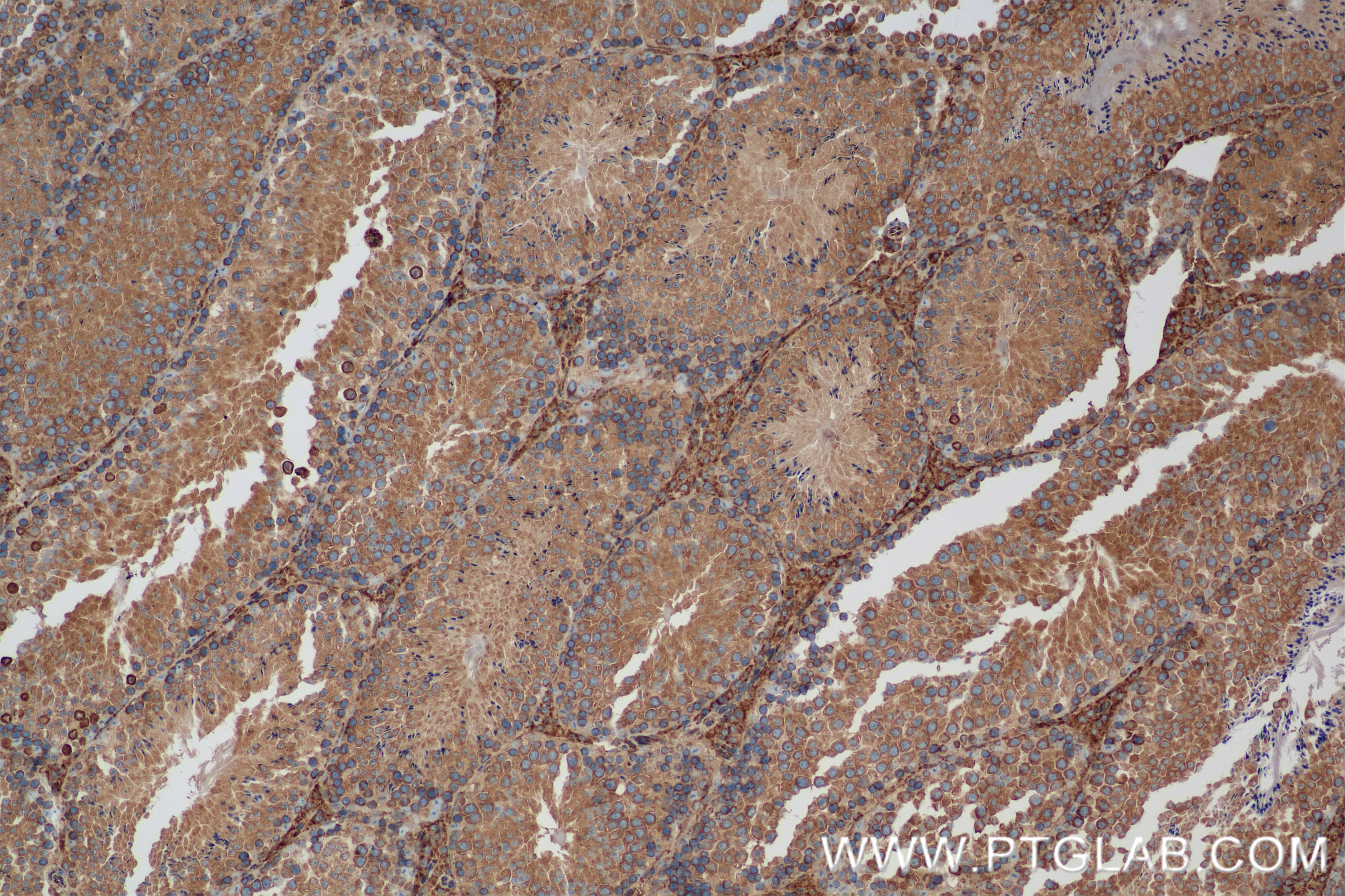 Immunohistochemistry (IHC) staining of mouse testis tissue using RCN2 Recombinant antibody (84956-4-RR)