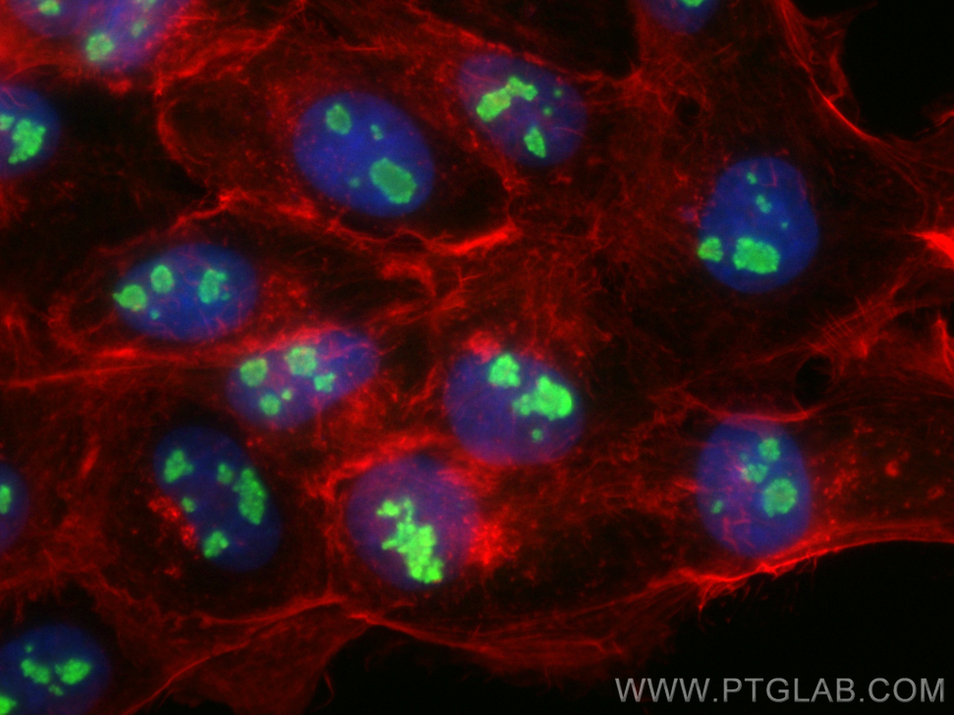 Immunofluorescence (IF) / fluorescent staining of A431 cells using RCOR3 Polyclonal antibody (55173-1-AP)