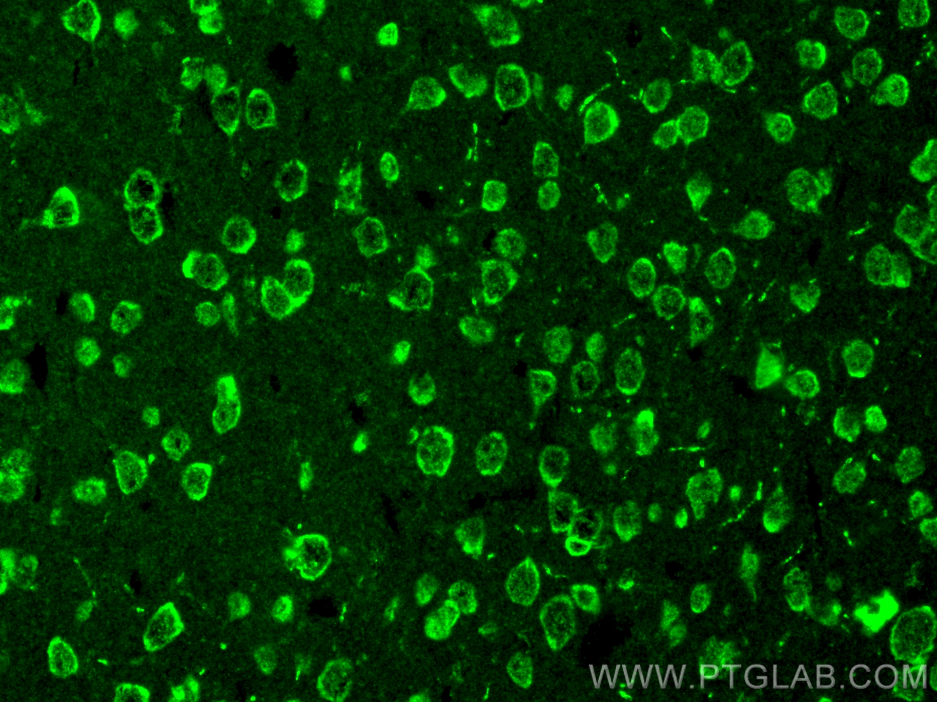 Immunofluorescence (IF) / fluorescent staining of mouse brain tissue using Recoverin Polyclonal antibody (10073-1-AP)