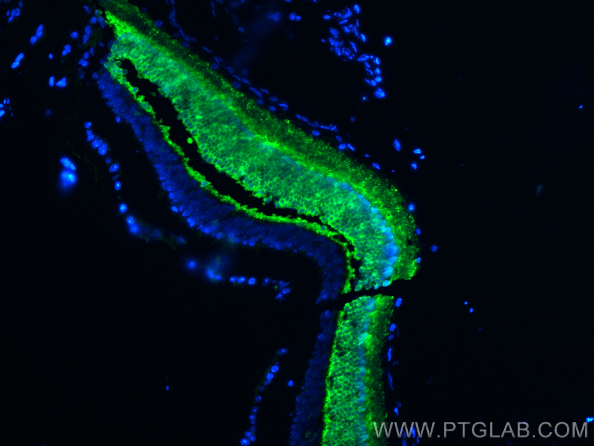 Immunofluorescence (IF) / fluorescent staining of mouse eye tissue using Recoverin Polyclonal antibody (10073-1-AP)