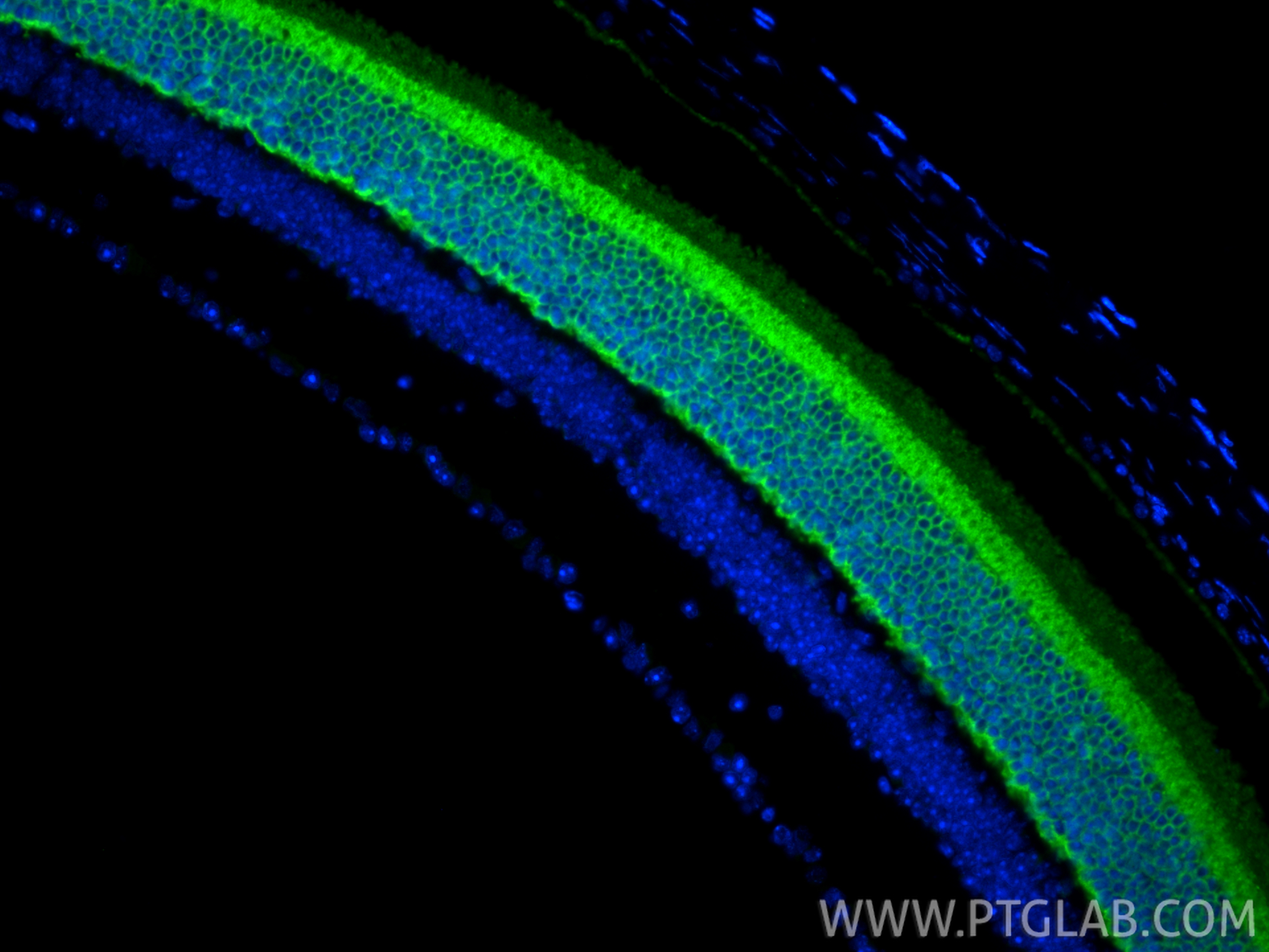 Immunofluorescence (IF) / fluorescent staining of mouse eye tissue using Recoverin Polyclonal antibody (10073-1-AP)