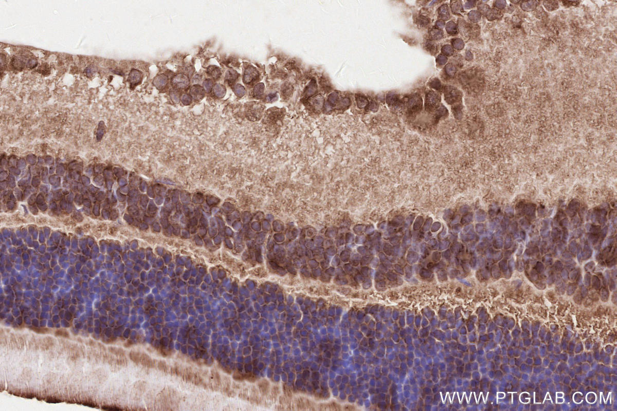 Immunohistochemistry (IHC) staining of mouse eye tissue using RD3 Polyclonal antibody (14855-1-AP)