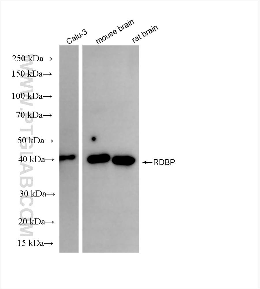 Western Blot (WB) analysis of various lysates using RDBP Recombinant antibody (85945-1-RR)