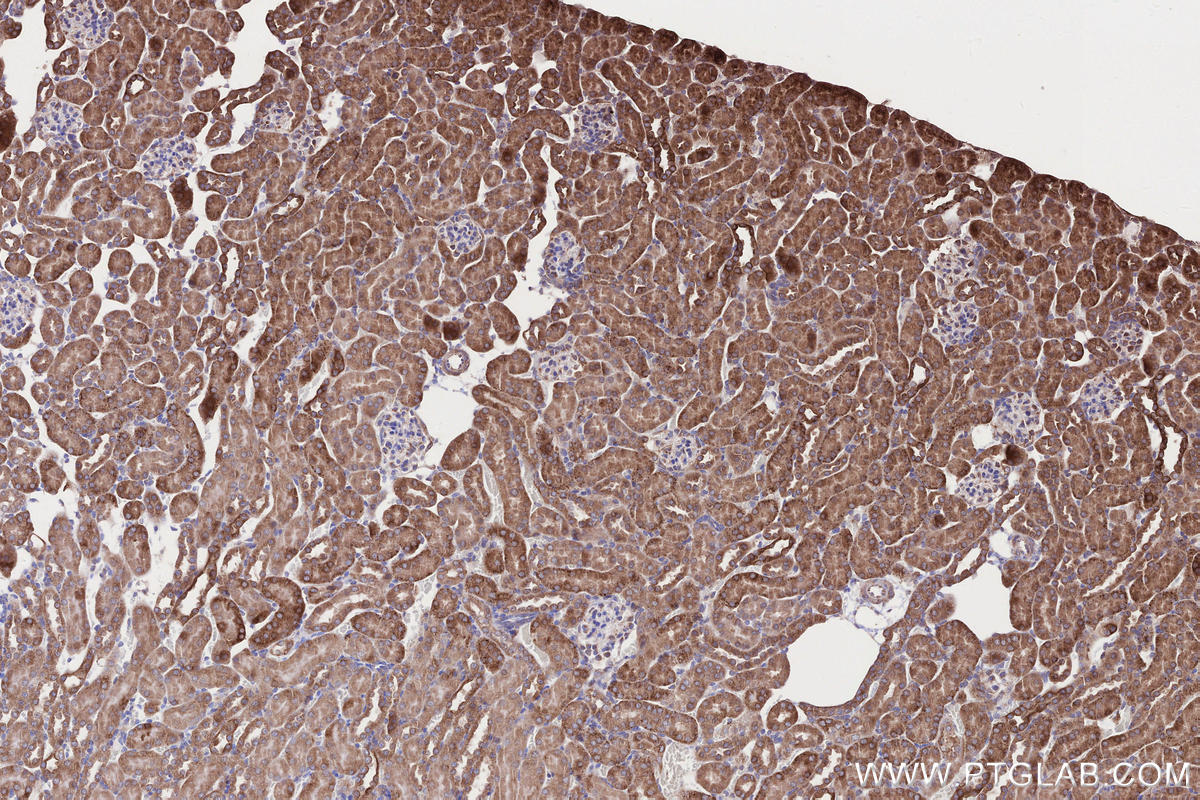 Immunohistochemistry (IHC) staining of mouse kidney tissue using RDH10 Polyclonal antibody (14644-1-AP)