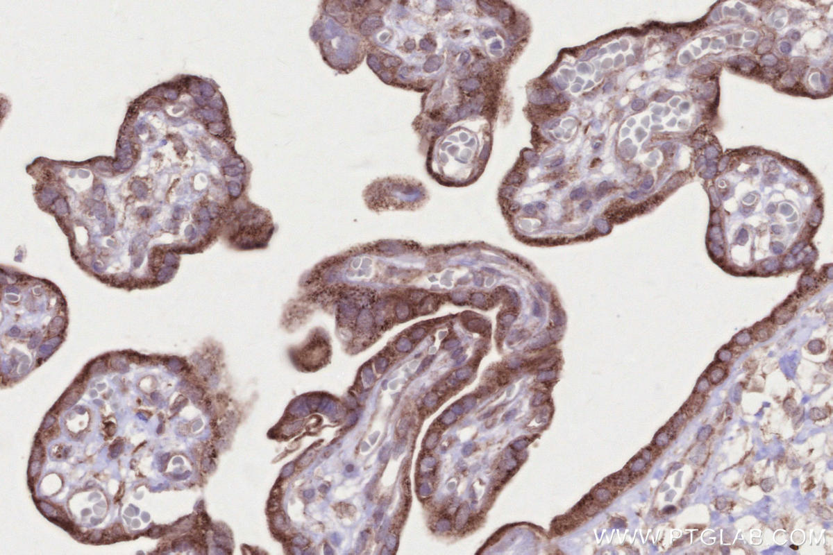 Immunohistochemistry (IHC) staining of human placenta tissue using RDH10 Polyclonal antibody (14644-1-AP)