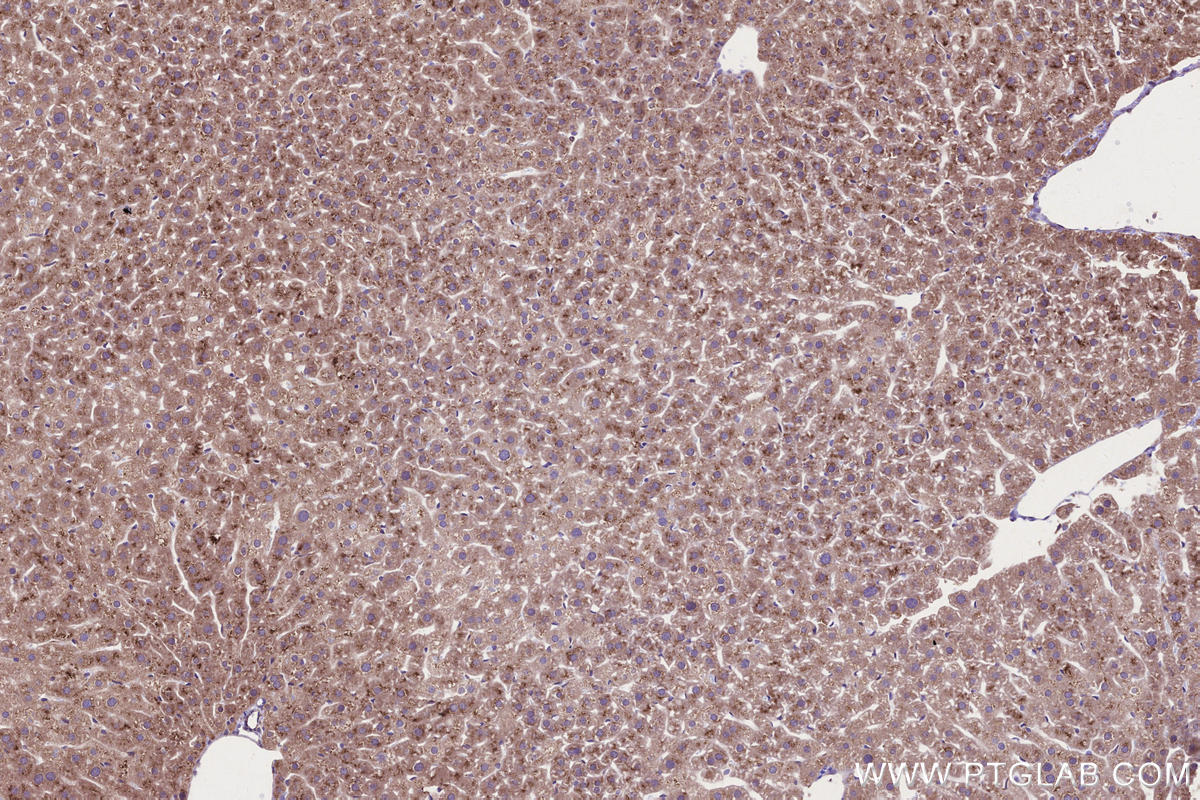 Immunohistochemistry (IHC) staining of mouse liver tissue using RDH10 Polyclonal antibody (14644-1-AP)