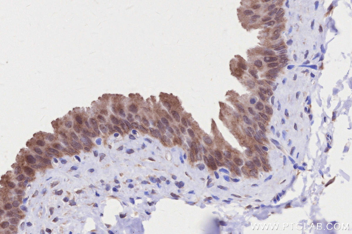 Immunohistochemistry (IHC) staining of rat bladder tissue using RDH10 Polyclonal antibody (14644-1-AP)