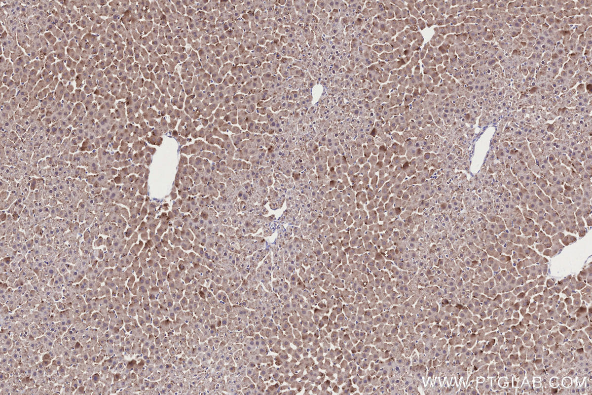 Immunohistochemistry (IHC) staining of rat liver tissue using RDH10 Polyclonal antibody (14644-1-AP)