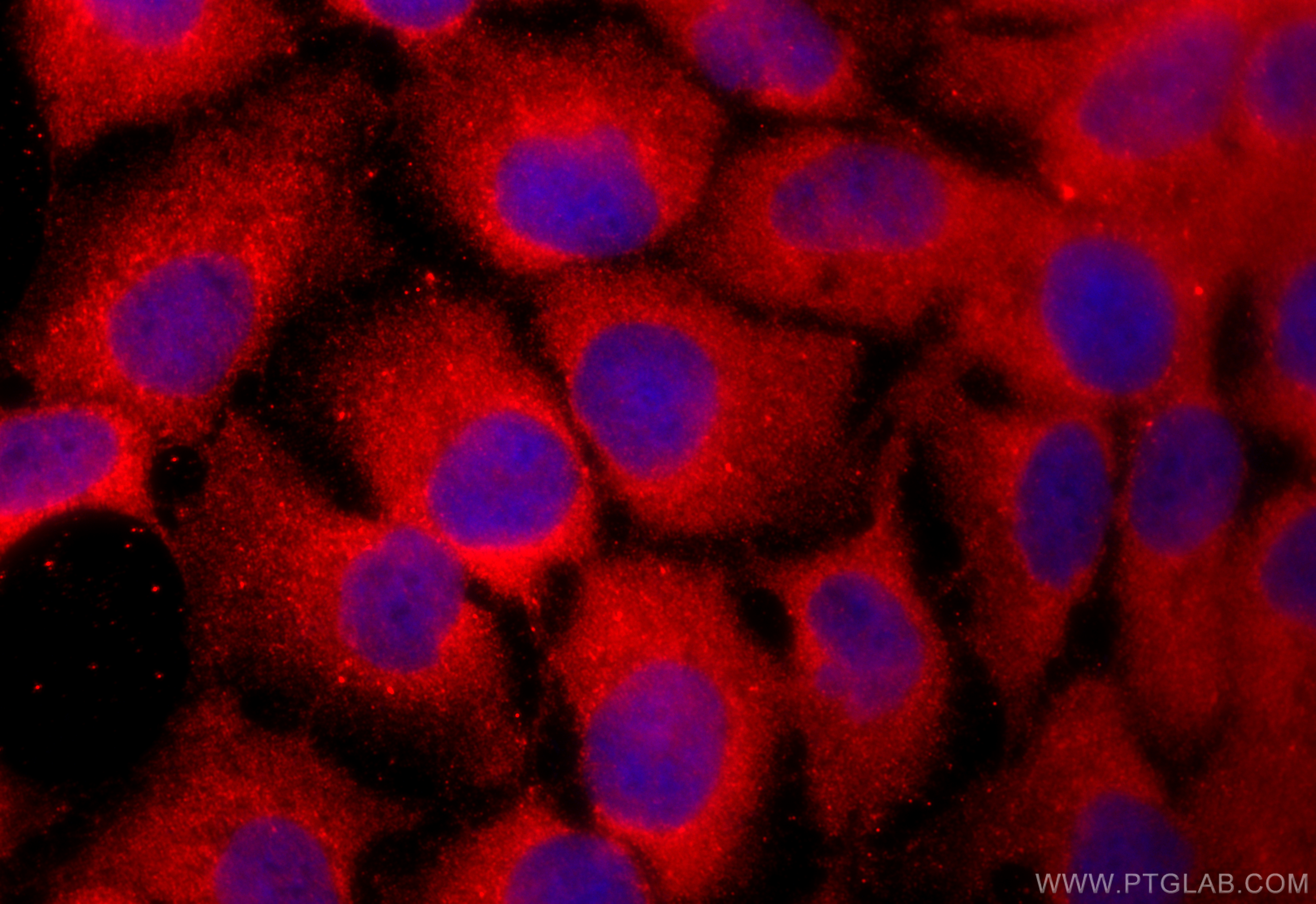 Immunofluorescence (IF) / fluorescent staining of HaCaT cells using RDH11 Polyclonal antibody (11077-1-AP)