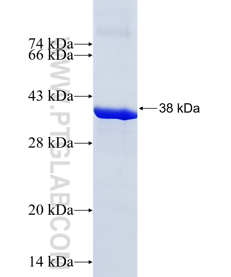 RDH12 fusion protein Ag28678 SDS-PAGE