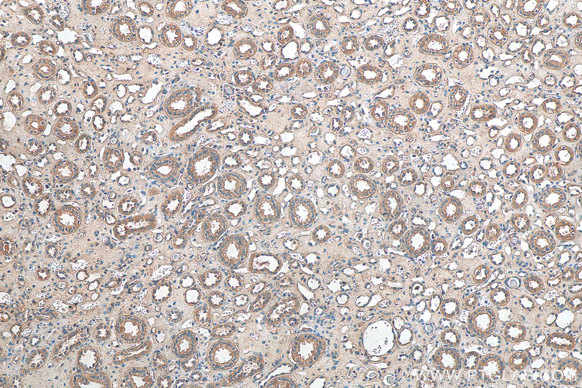 Immunohistochemistry (IHC) staining of human kidney tissue using RDH14 Polyclonal antibody (16283-1-AP)