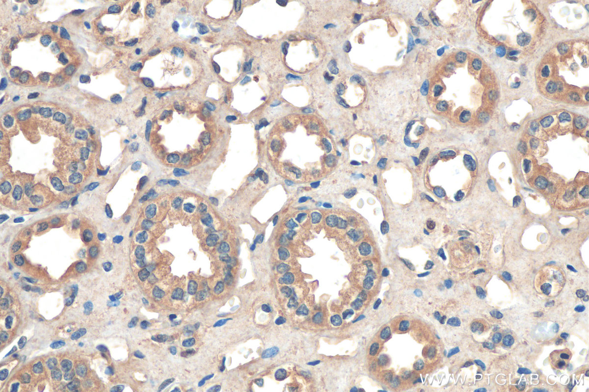 Immunohistochemistry (IHC) staining of human kidney tissue using RDH14 Polyclonal antibody (16283-1-AP)