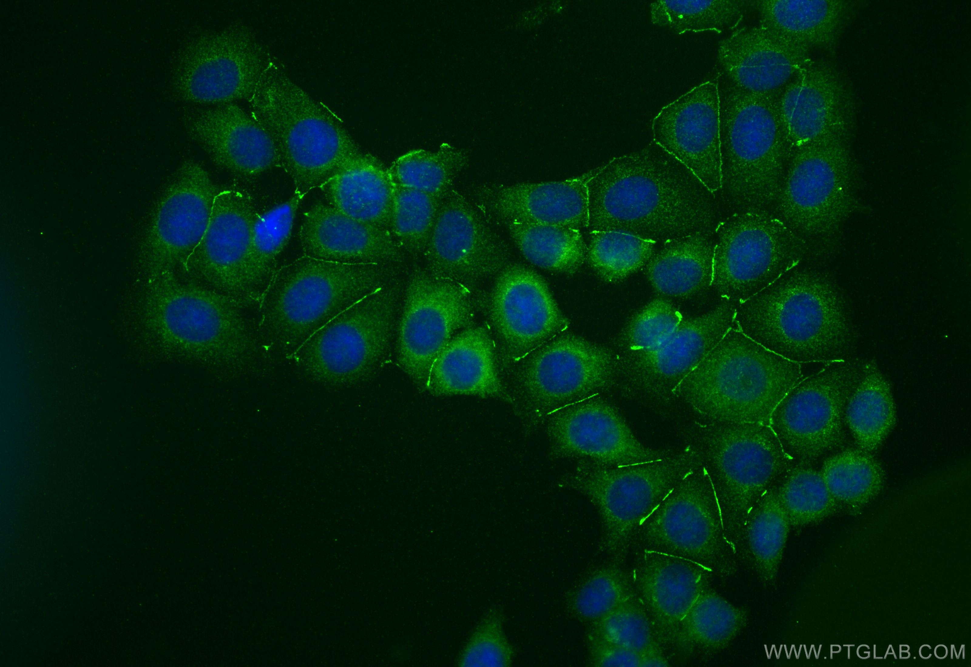 Immunofluorescence (IF) / fluorescent staining of MCF-7 cells using Radixin Polyclonal antibody (13790-1-AP)