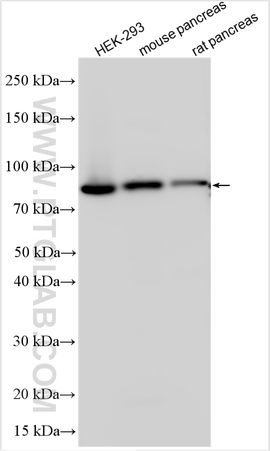 Western Blot (WB) analysis of various lysates using Radixin Polyclonal antibody (13790-1-AP)