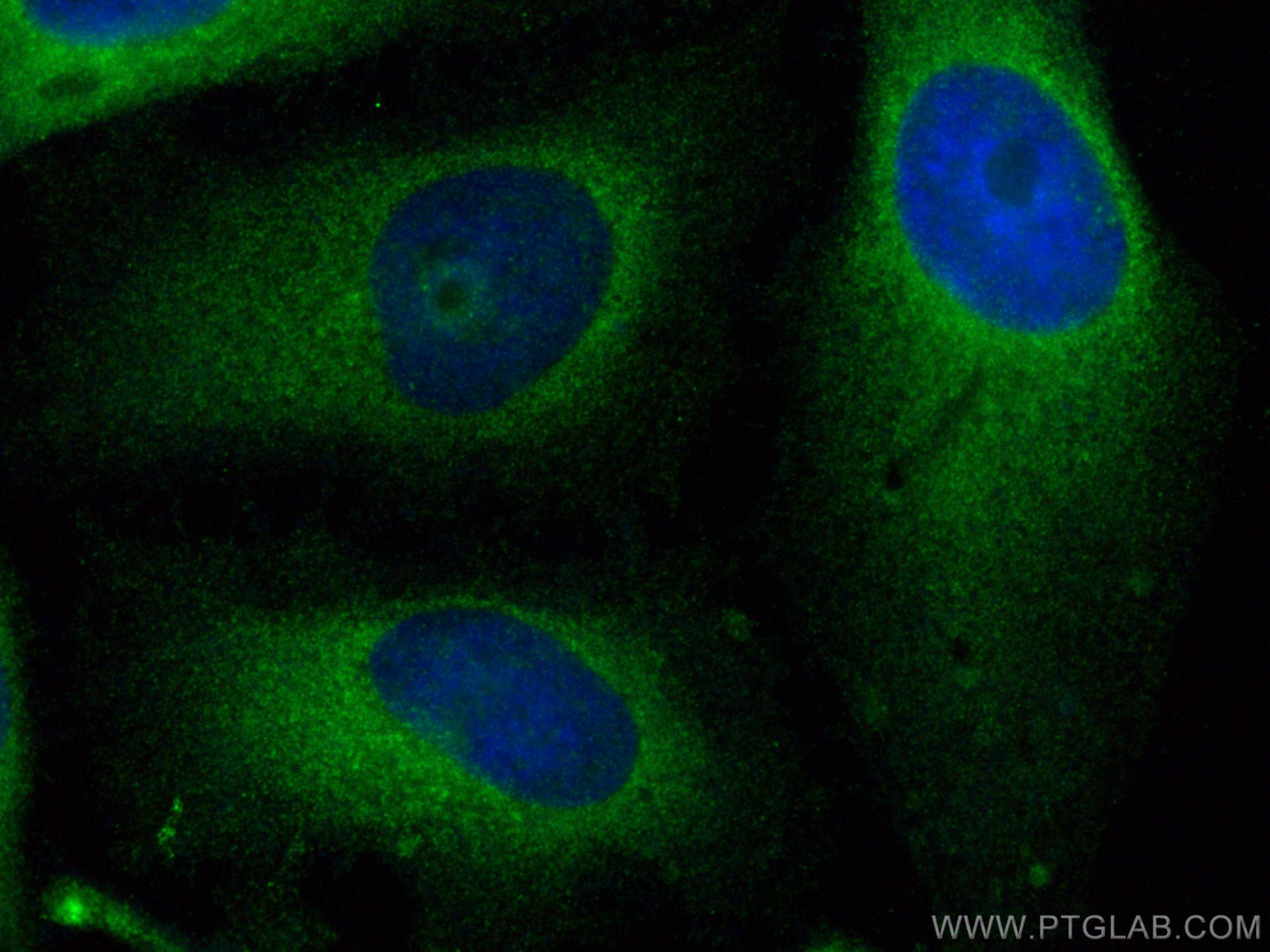 Immunofluorescence (IF) / fluorescent staining of HeLa cells using REEP4 Polyclonal antibody (26650-1-AP)