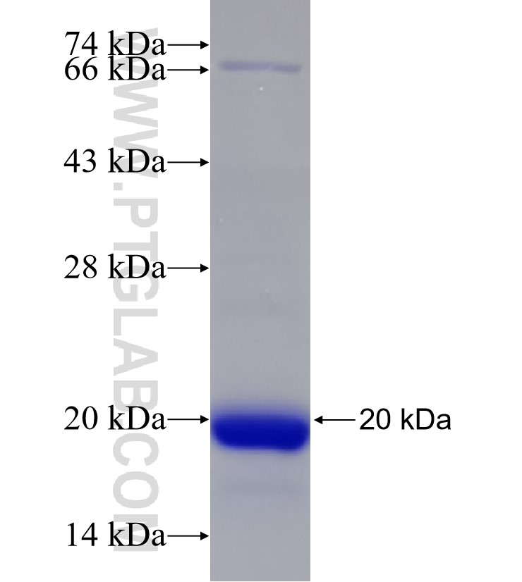 REEP4 fusion protein Ag33149 SDS-PAGE