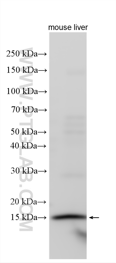 Western Blot (WB) analysis of various lysates using REG4 Polyclonal antibody (12268-1-AP)