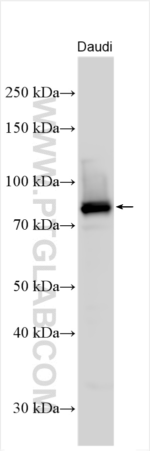 Western Blot (WB) analysis of various lysates using REL Polyclonal antibody (27693-1-AP)