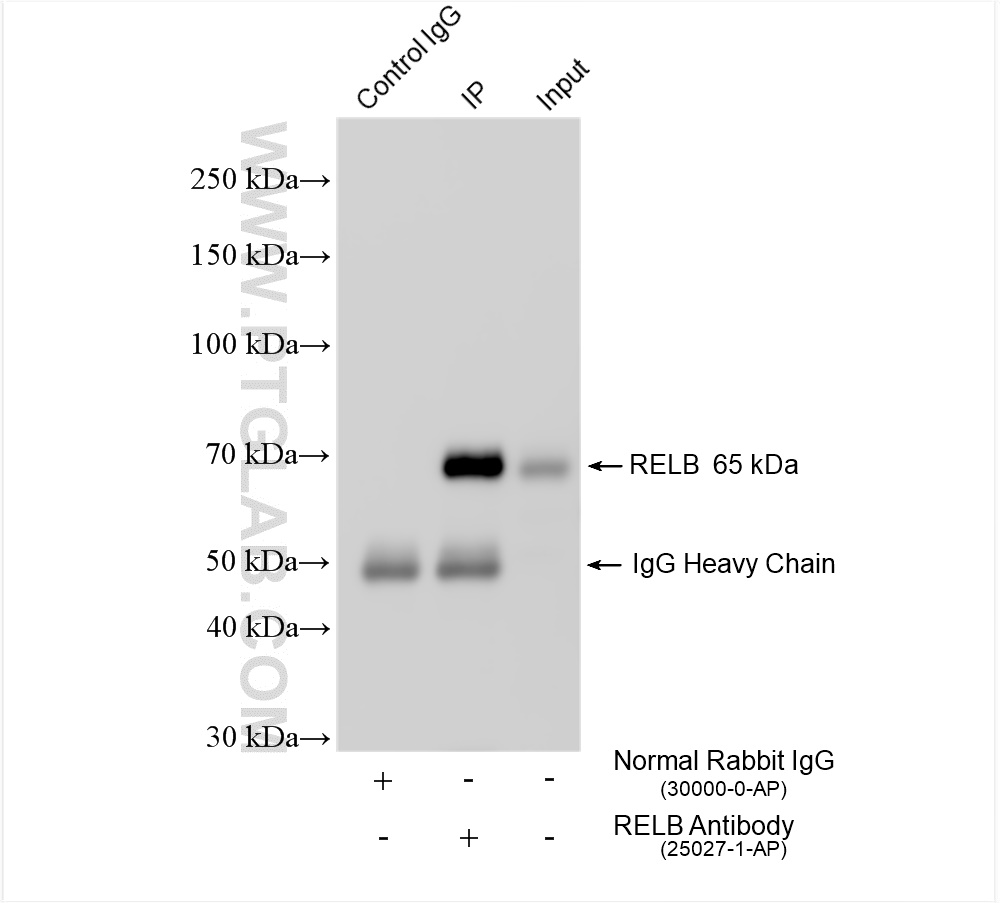 Immunoprecipitation (IP) experiment of Raji cells using RELB Polyclonal antibody (25027-1-AP)