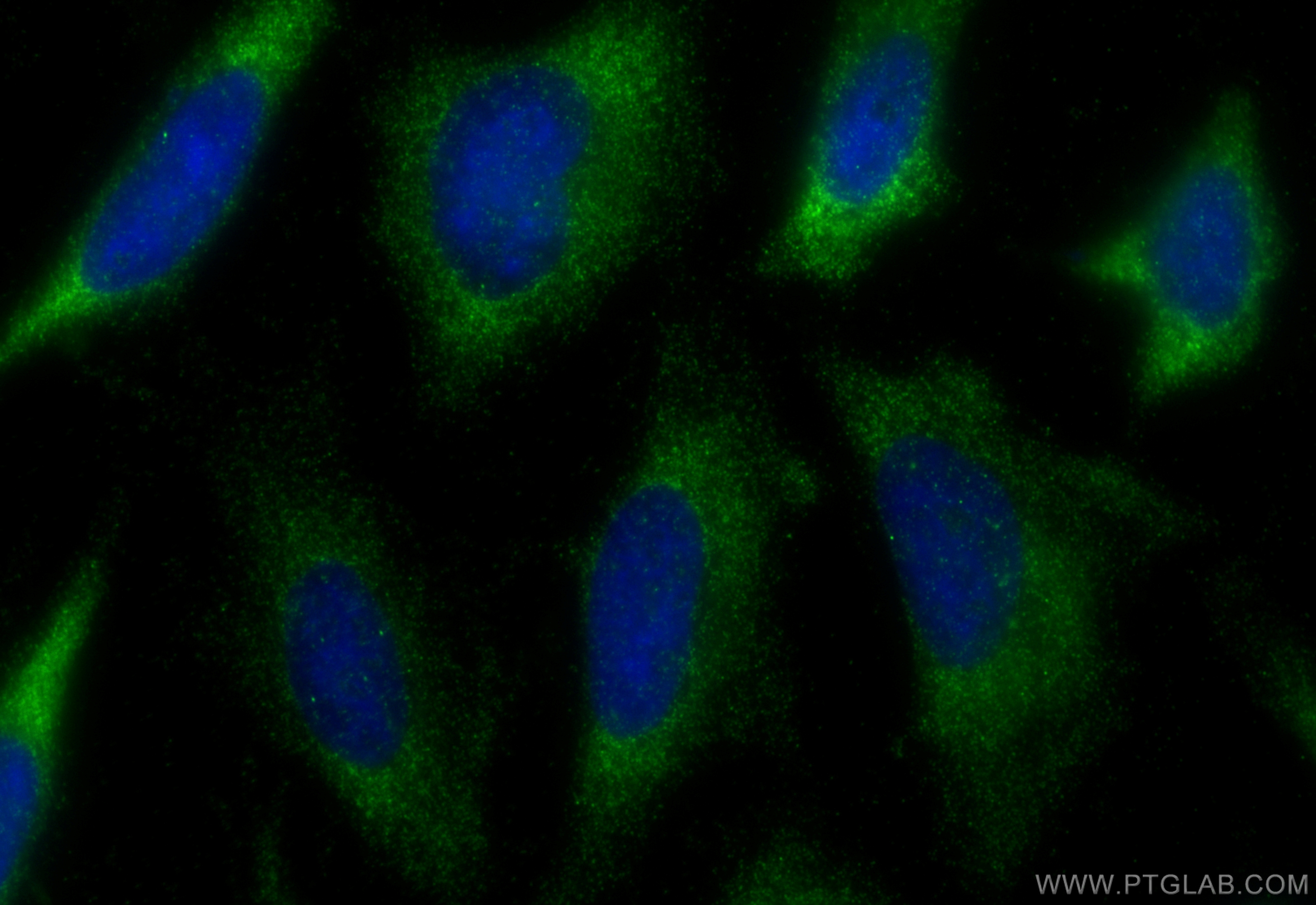 Immunofluorescence (IF) / fluorescent staining of HeLa cells using Renin Polyclonal antibody (14291-1-AP)