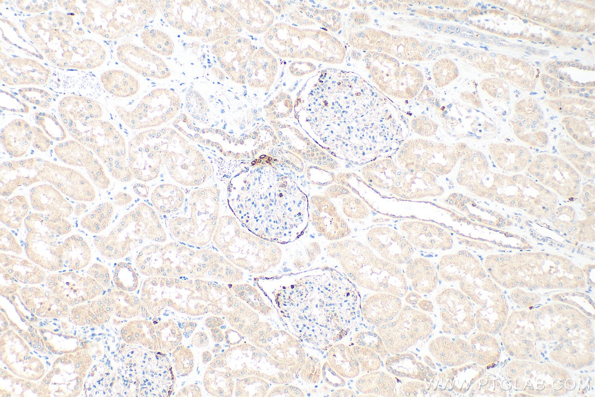 Immunohistochemistry (IHC) staining of human kidney tissue using Renin Polyclonal antibody (14291-1-AP)