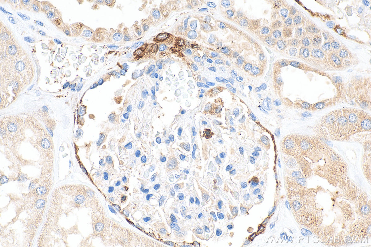 Immunohistochemistry (IHC) staining of human kidney tissue using Renin Polyclonal antibody (14291-1-AP)