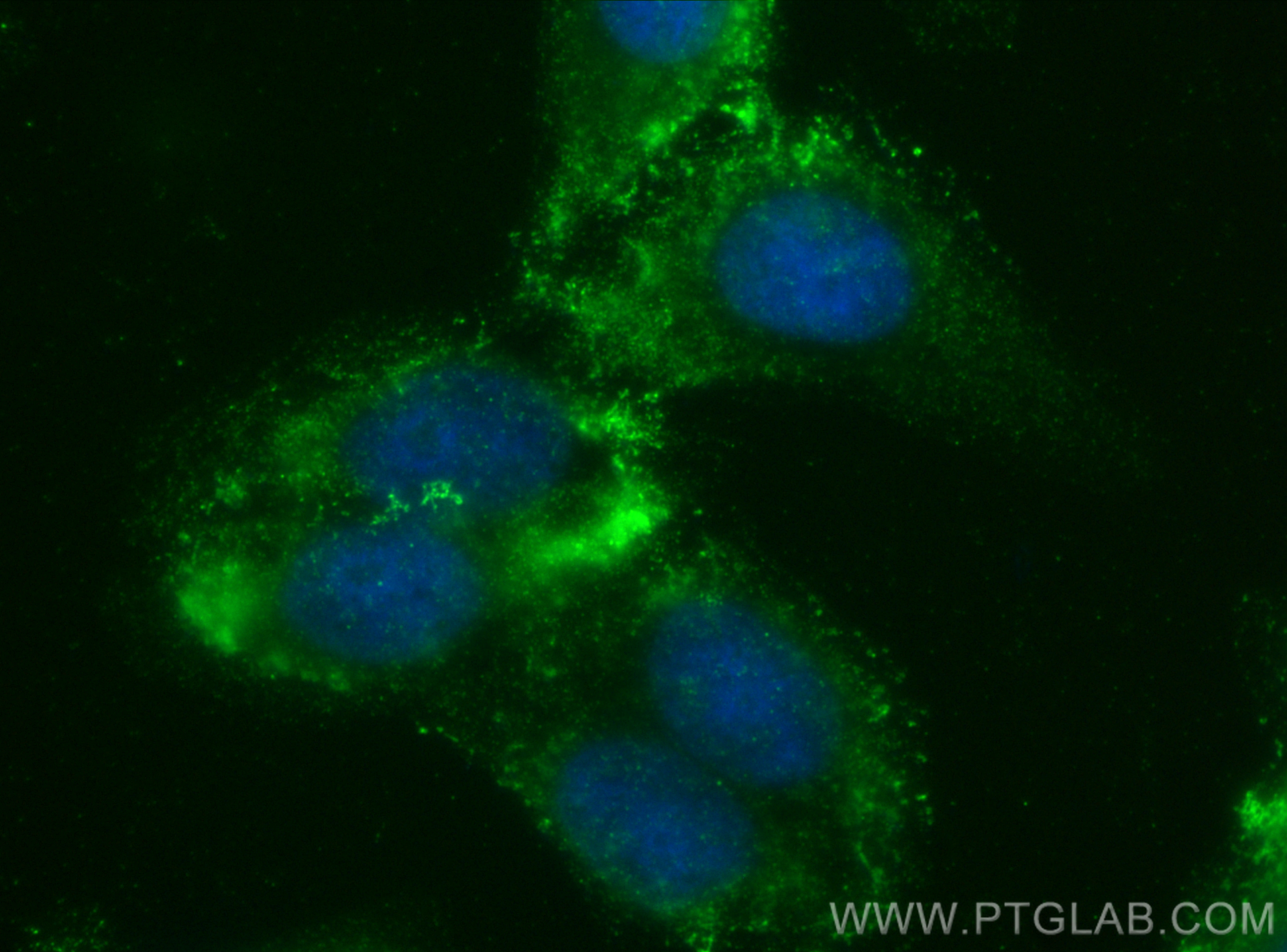 Immunofluorescence (IF) / fluorescent staining of HepG2 cells using Renin Polyclonal antibody (29330-1-AP)