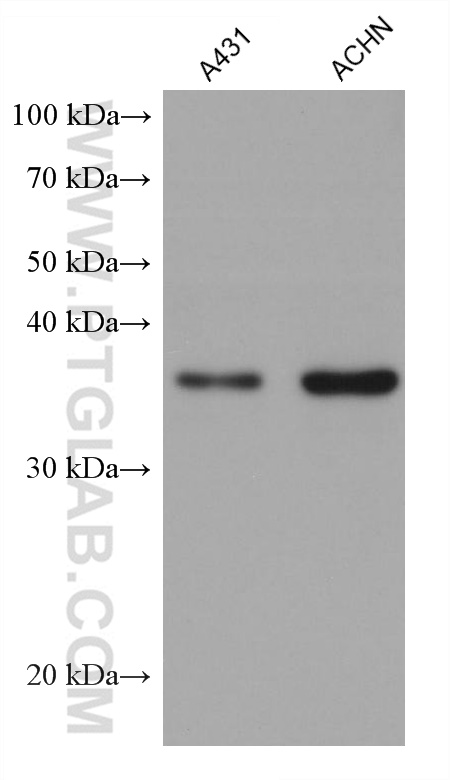 Western Blot (WB) analysis of various lysates using RENALASE Monoclonal antibody (60128-1-Ig)