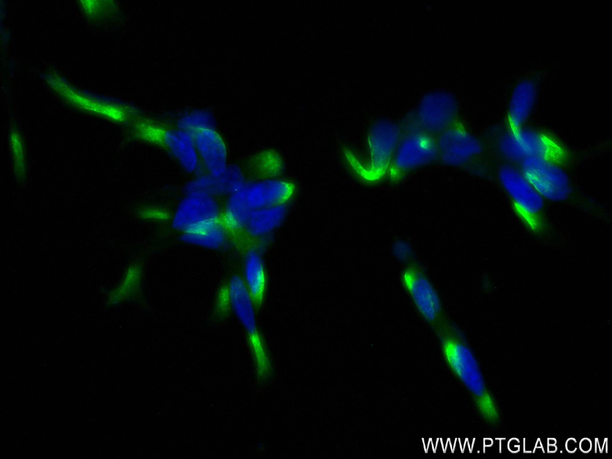 Immunofluorescence (IF) / fluorescent staining of LNCaP cells using REPS2 Recombinant antibody (84016-4-RR)