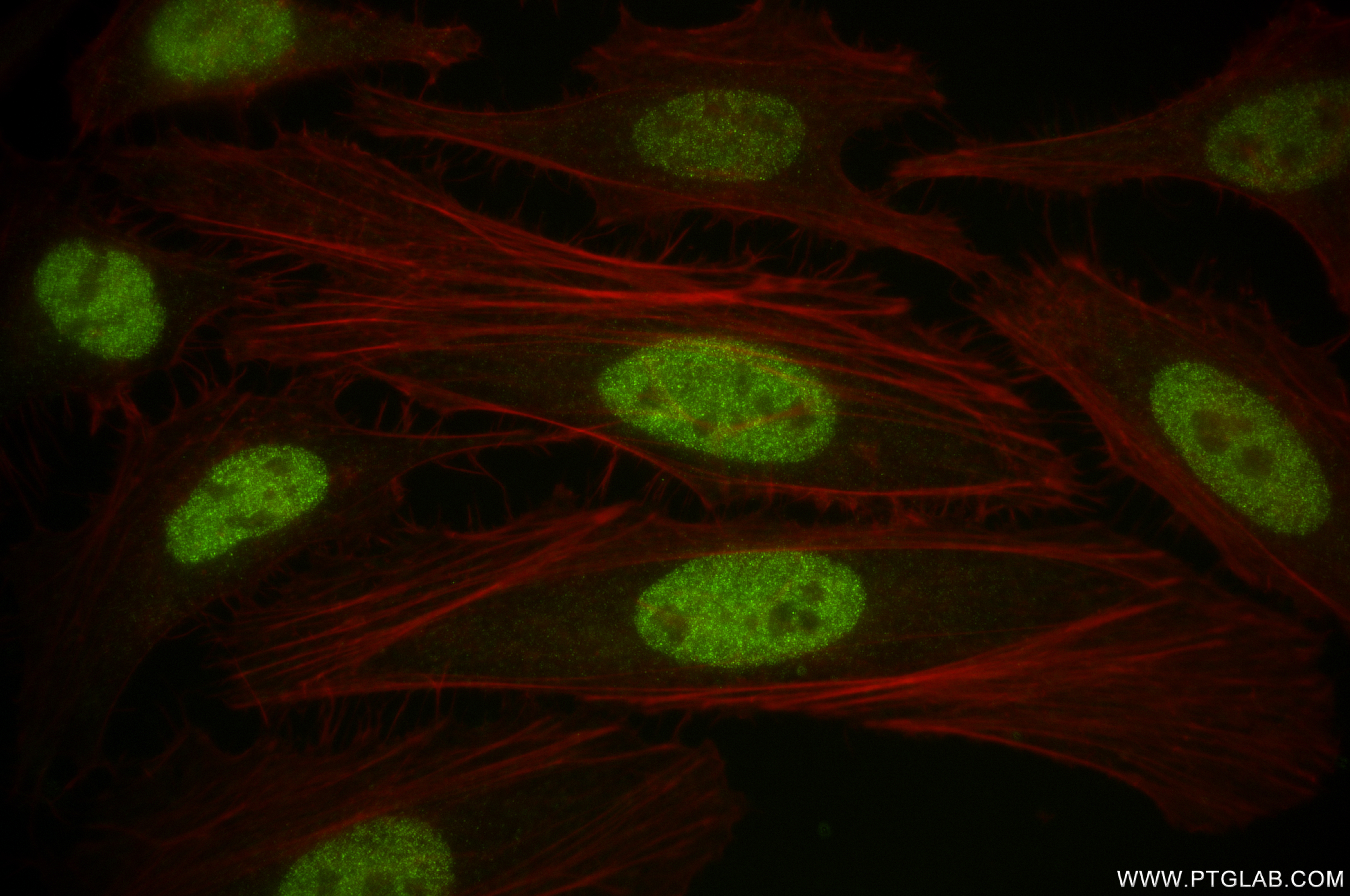 Immunofluorescence (IF) / fluorescent staining of HeLa cells using REST Recombinant antibody (84846-4-RR)