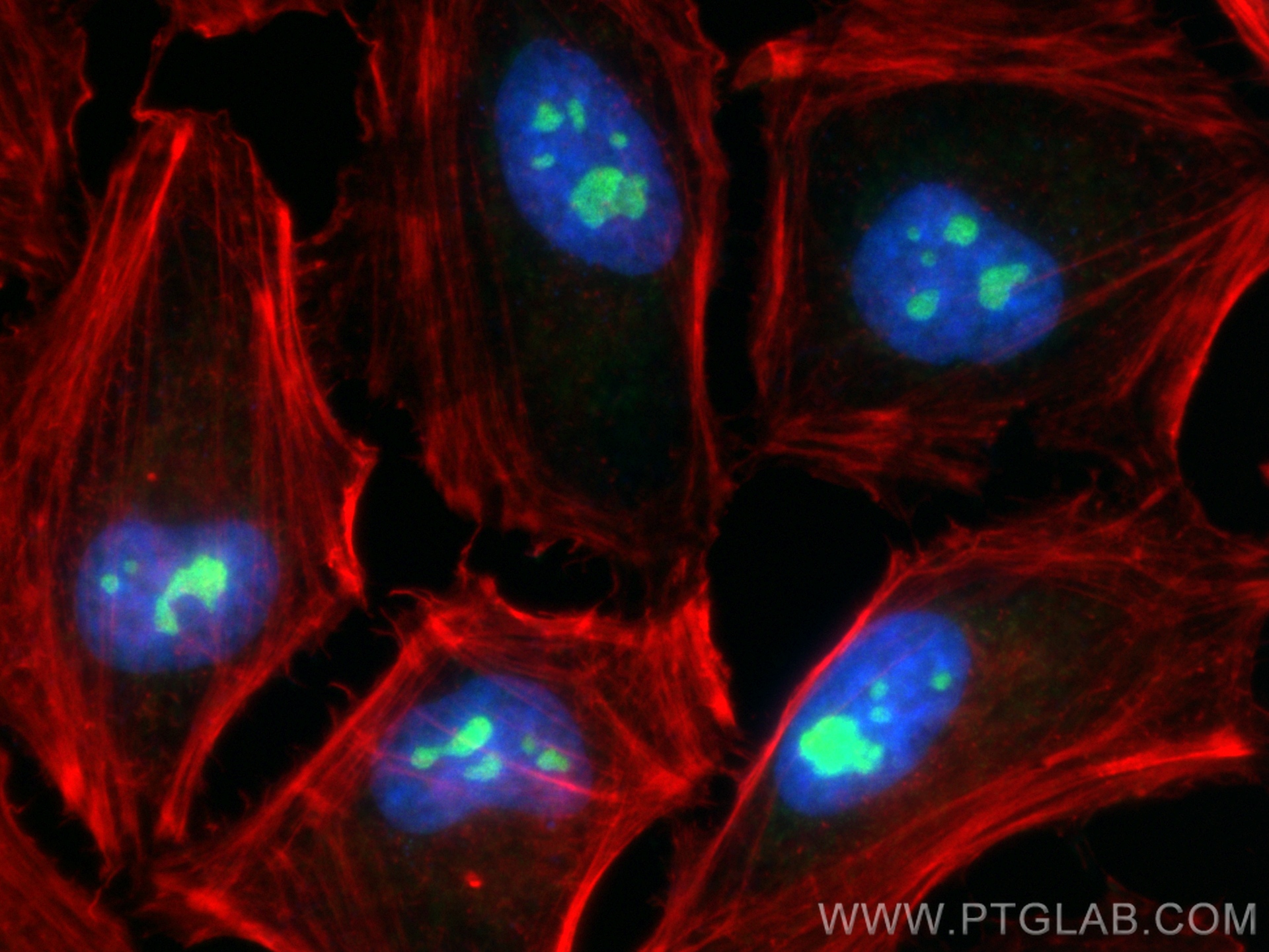 Immunofluorescence (IF) / fluorescent staining of HeLa cells using REXO4 Polyclonal antibody (18890-1-AP)