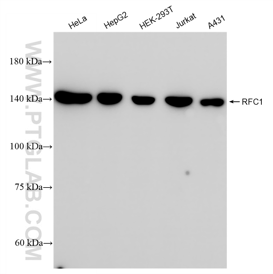 Western Blot (WB) analysis of HeLa cells using RFC1 Recombinant antibody (85148-1-RR)