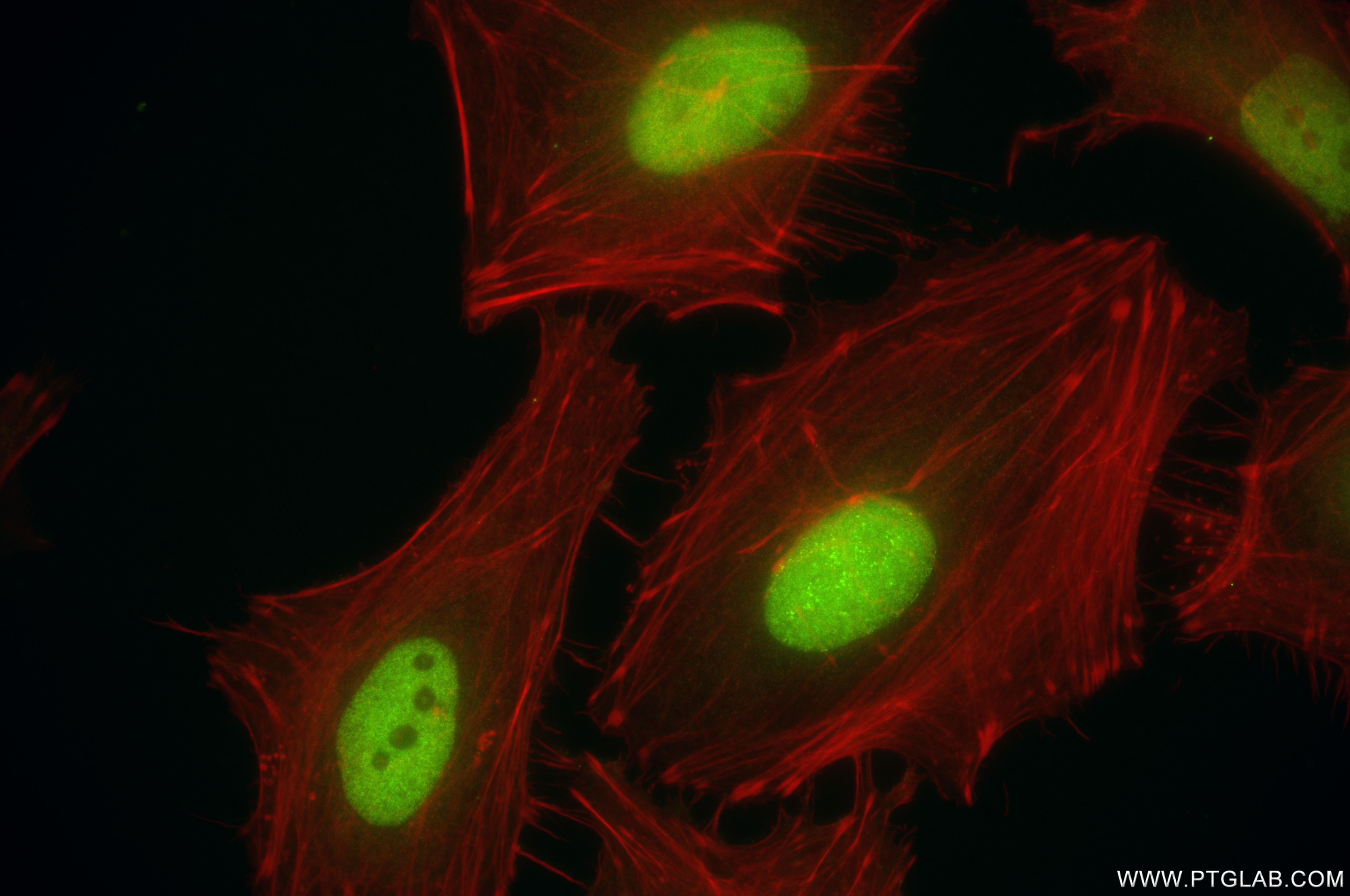 Immunofluorescence (IF) / fluorescent staining of HeLa cells using RFC2 Recombinant antibody (84892-1-RR)