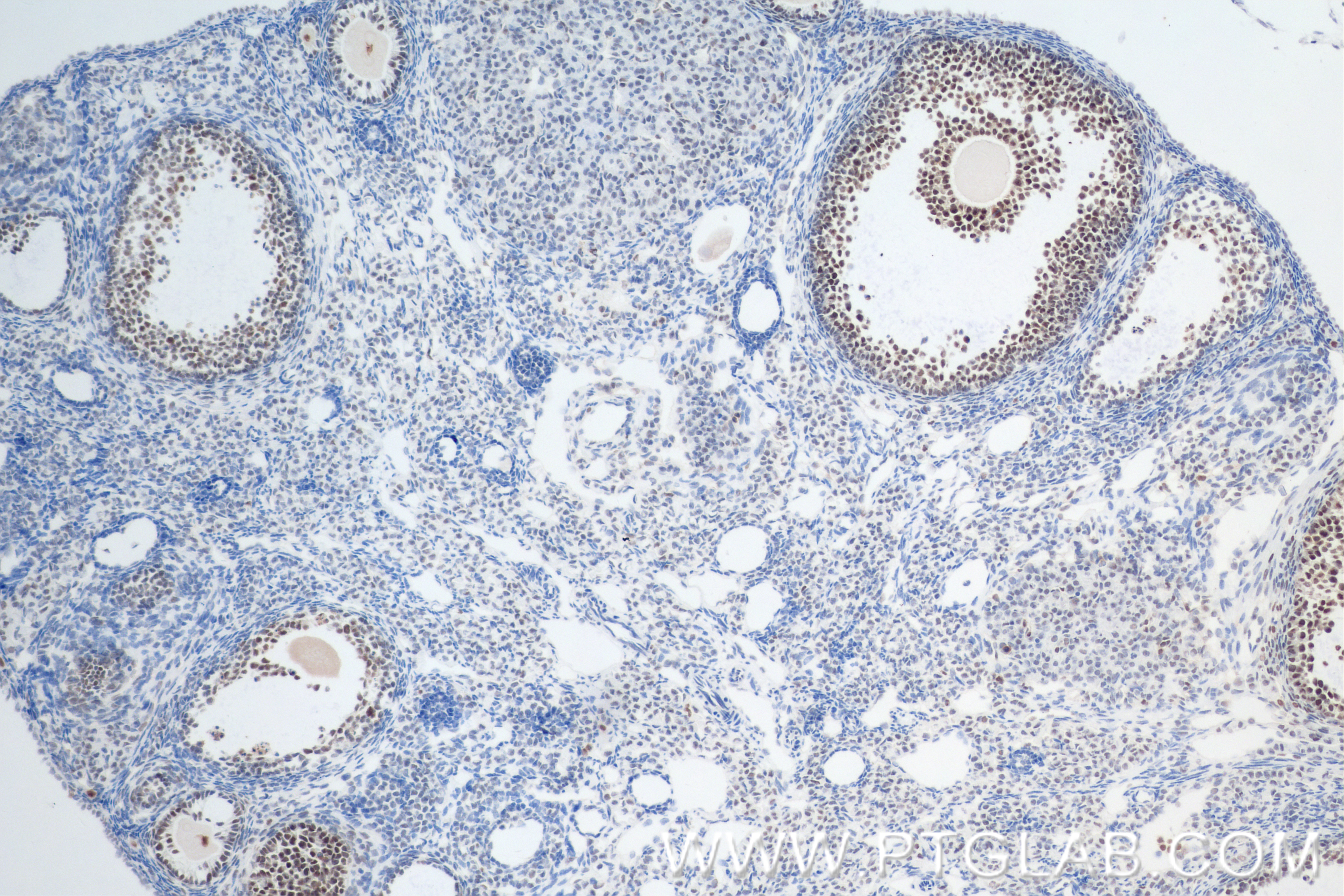 Immunohistochemistry (IHC) staining of mouse ovary tissue using RFC2 Recombinant antibody (84892-1-RR)