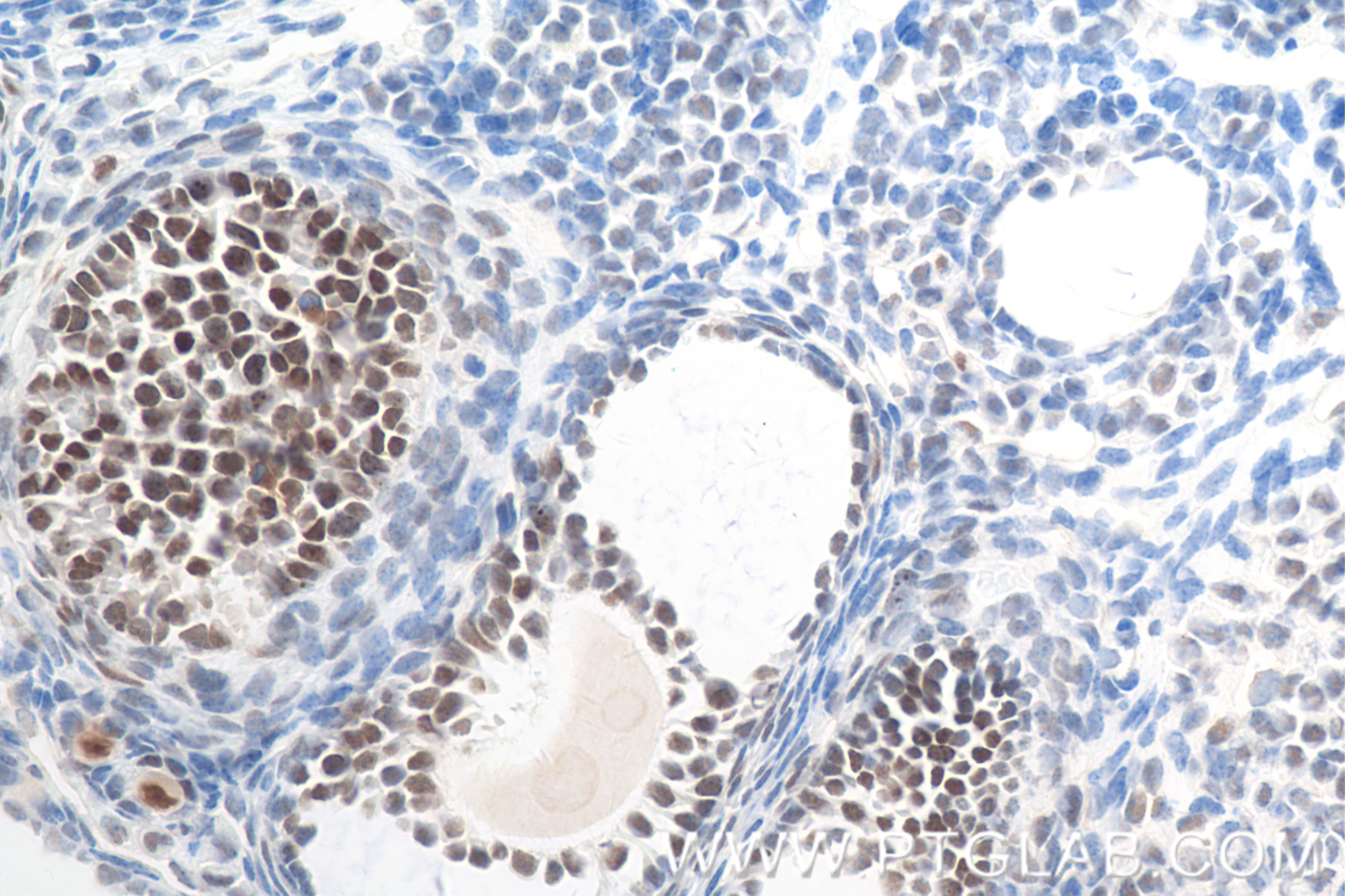 Immunohistochemistry (IHC) staining of mouse ovary tissue using RFC2 Recombinant antibody (84892-1-RR)