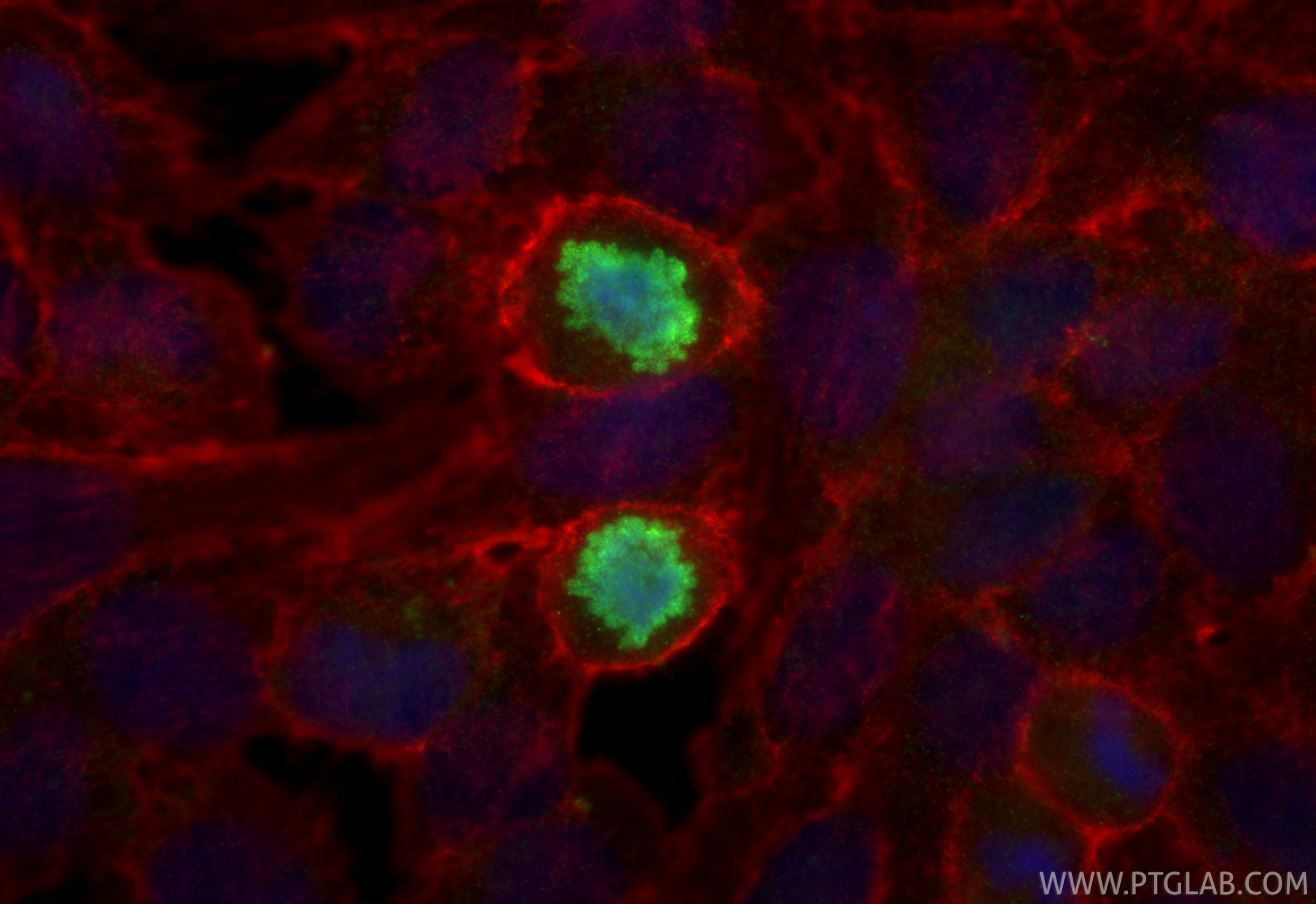 Immunofluorescence (IF) / fluorescent staining of U2OS cells using RFC3 Polyclonal antibody (11814-1-AP)