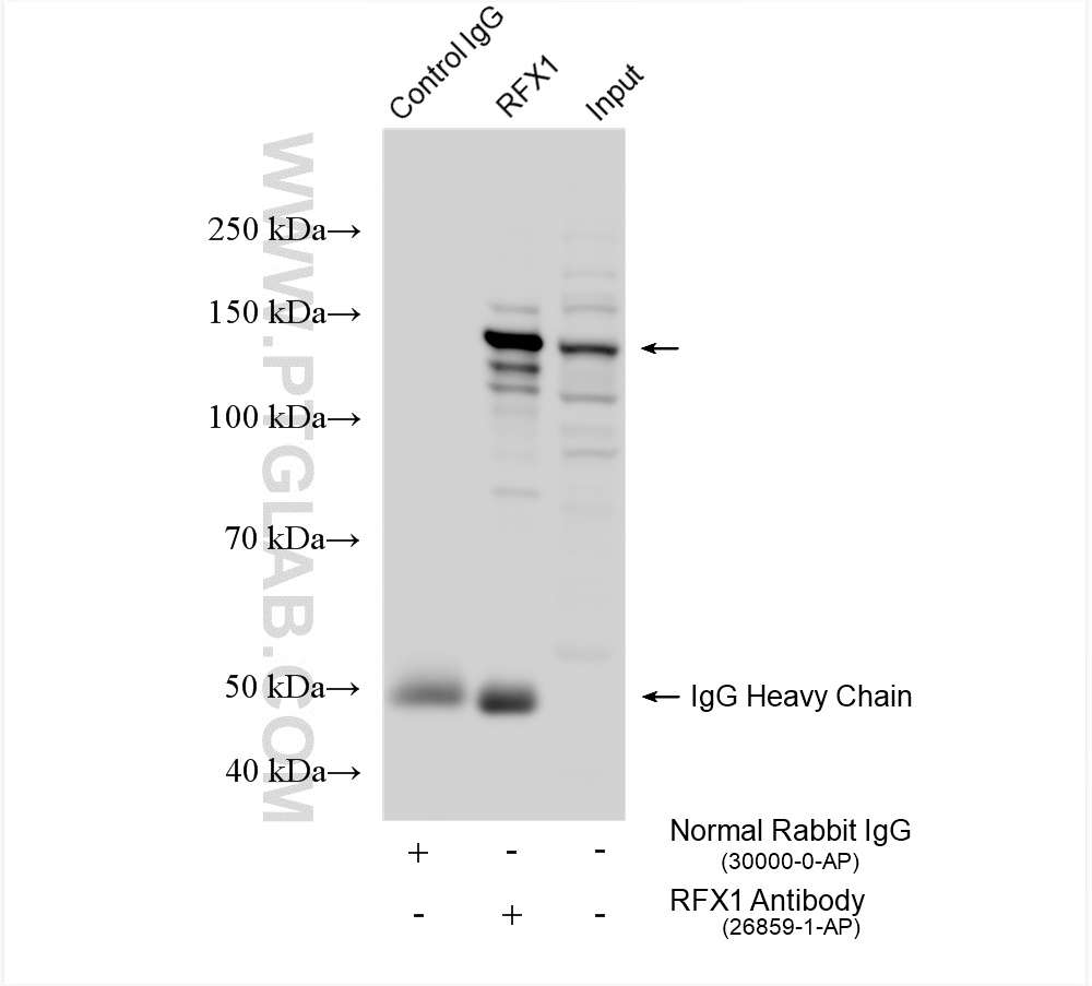 Immunoprecipitation (IP) experiment of Jurkat cells using RFX1 Polyclonal antibody (26859-1-AP)