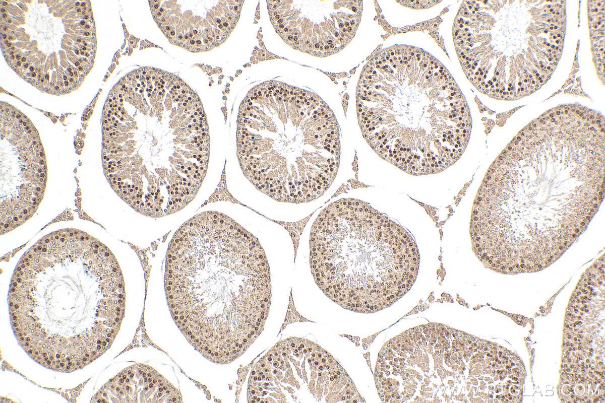 Immunohistochemistry (IHC) staining of rat testis tissue using RFX2 Polyclonal antibody (12622-1-AP)