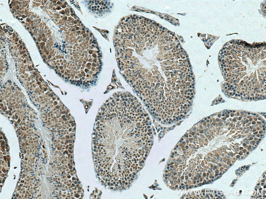 RFX2 antibody (26313-1-AP) | Proteintech