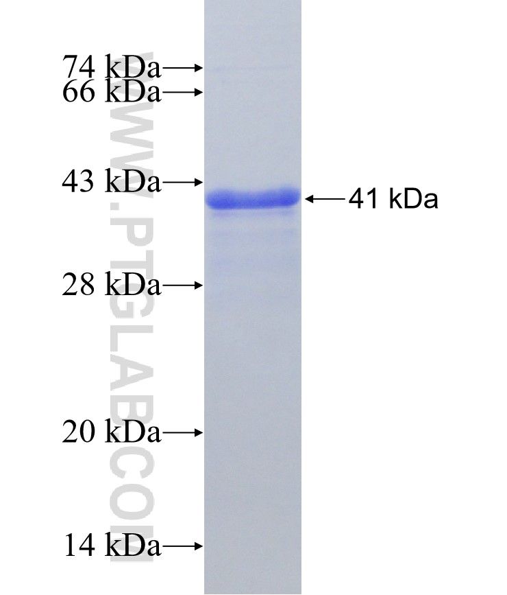 RGC32 fusion protein Ag30568 SDS-PAGE