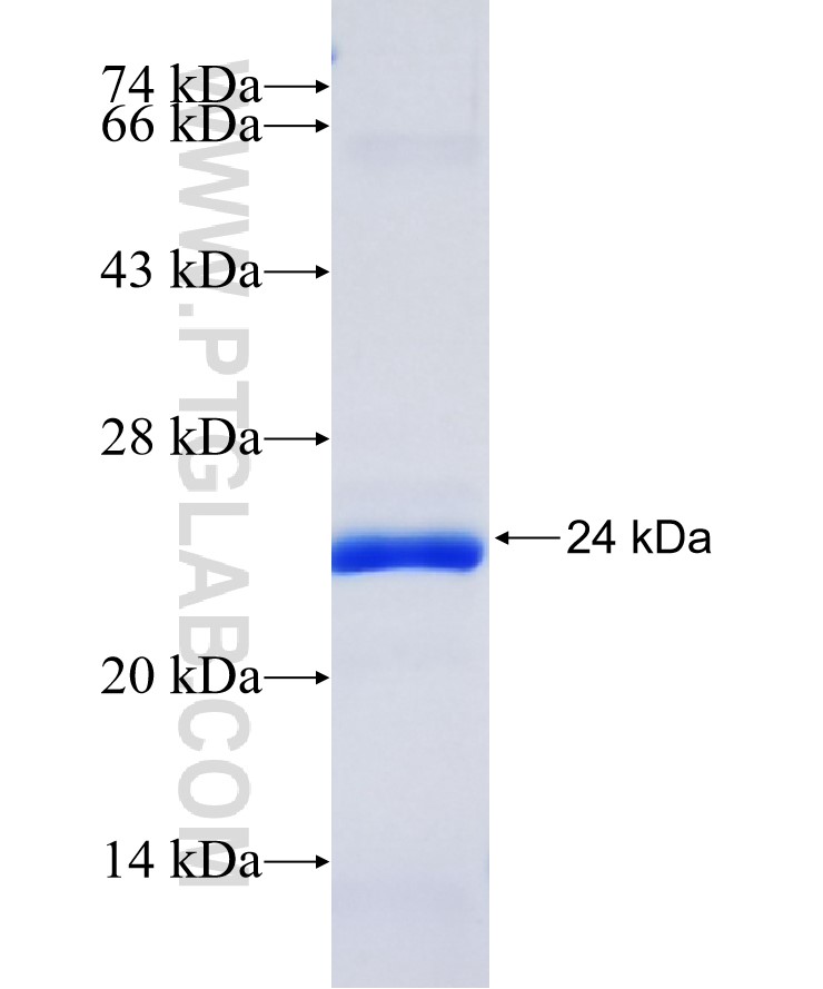 RGS10 fusion protein Ag28751 SDS-PAGE