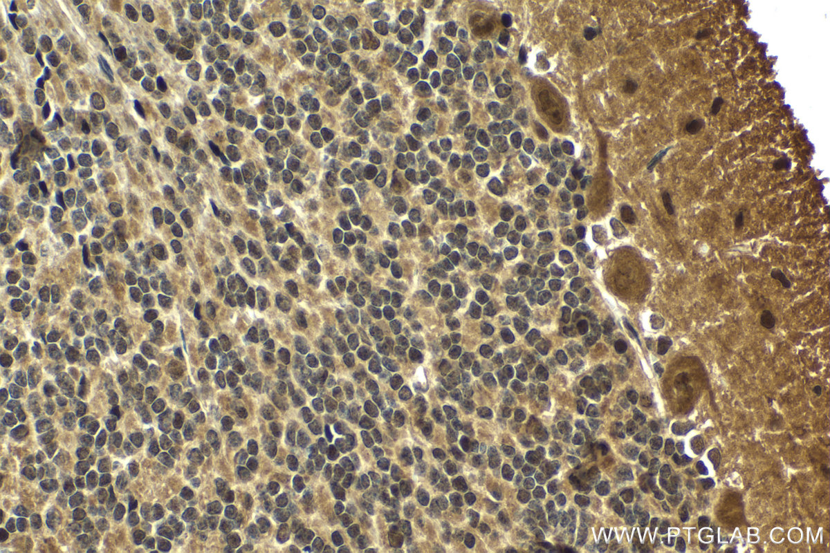 Immunohistochemistry (IHC) staining of rat cerebellum tissue using RGS12 Polyclonal antibody (29803-1-AP)