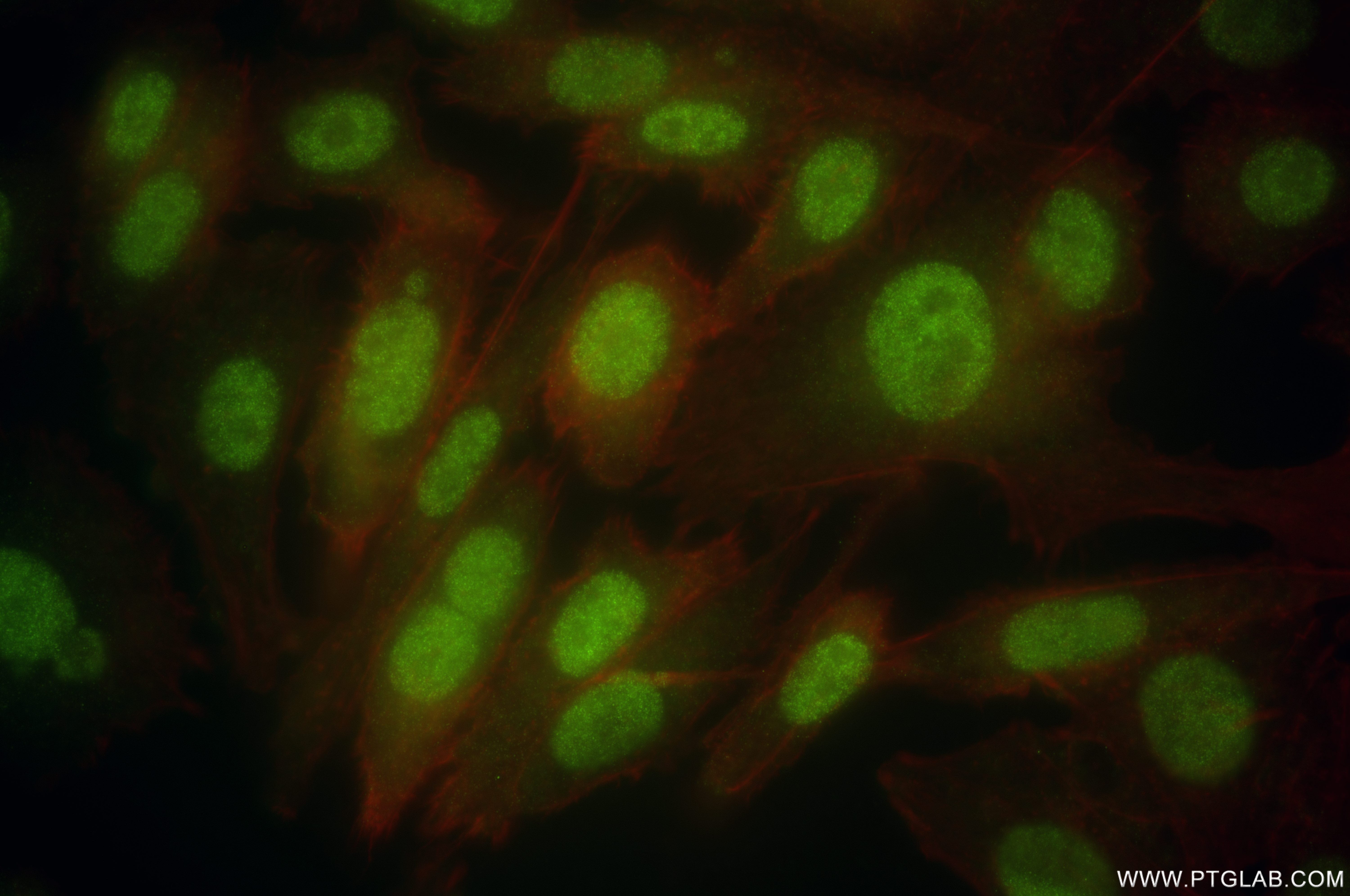 Immunofluorescence (IF) / fluorescent staining of PC-3 cells using RGS12 Recombinant antibody (85057-2-RR)