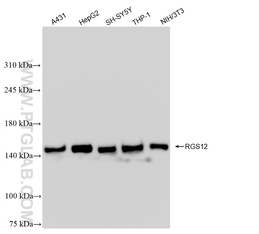 Western Blot (WB) analysis of various lysates using RGS12 Recombinant antibody (85057-2-RR)