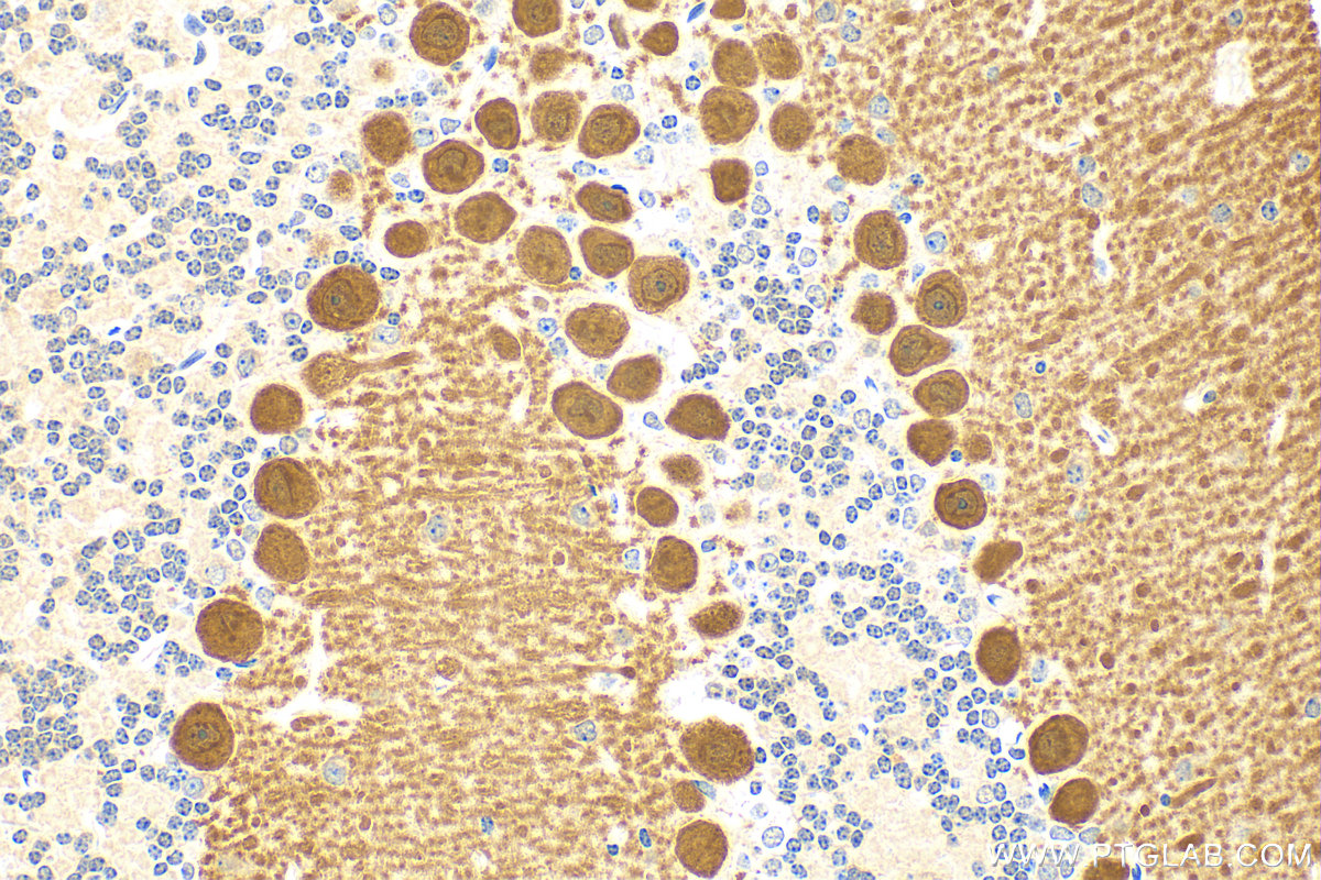 Immunohistochemistry (IHC) staining of mouse cerebellum tissue using RGS8 Polyclonal antibody (27394-1-AP)