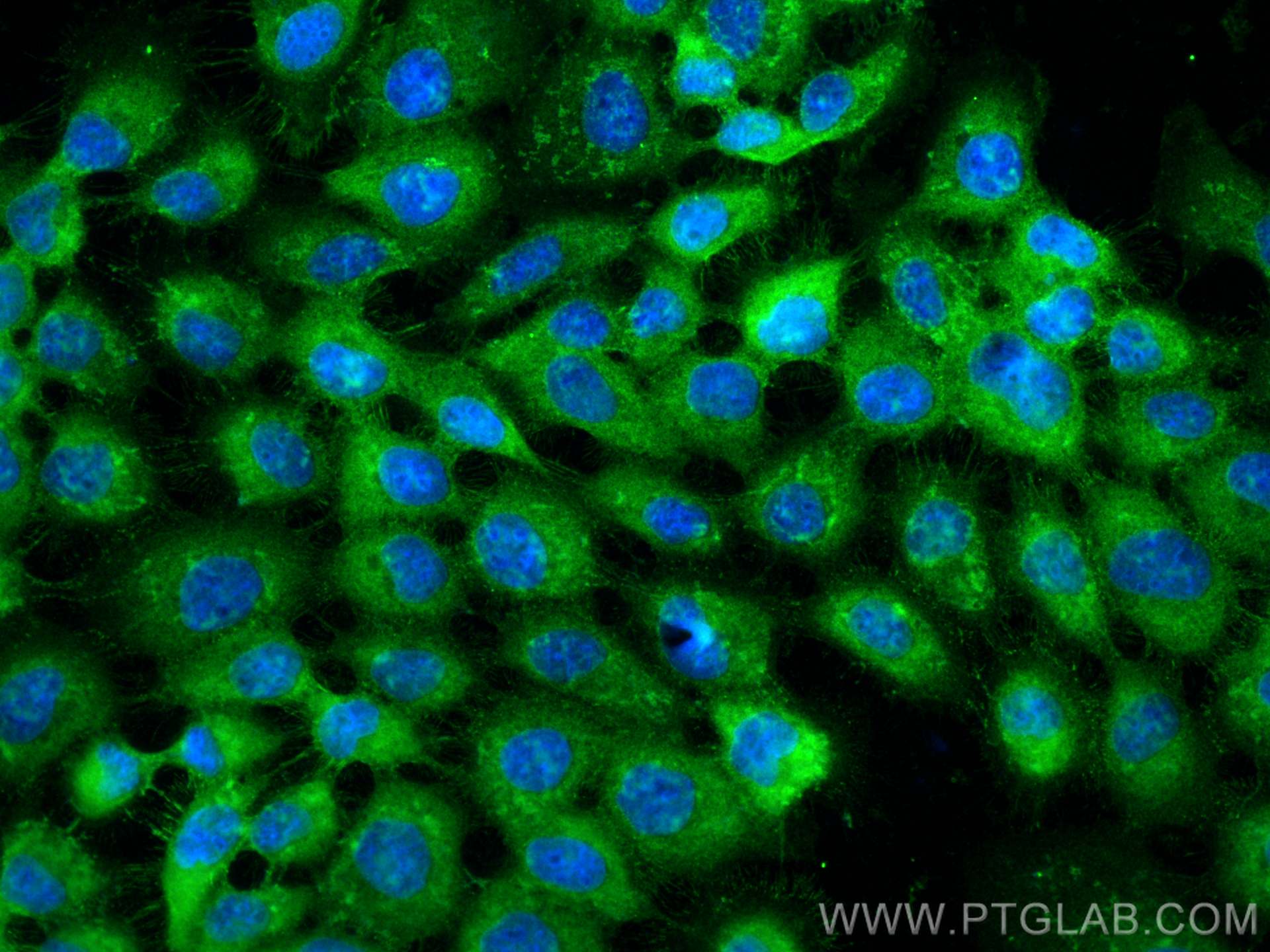 Immunofluorescence (IF) / fluorescent staining of A431 cells using RHBDF2 Polyclonal antibody (23181-1-AP)