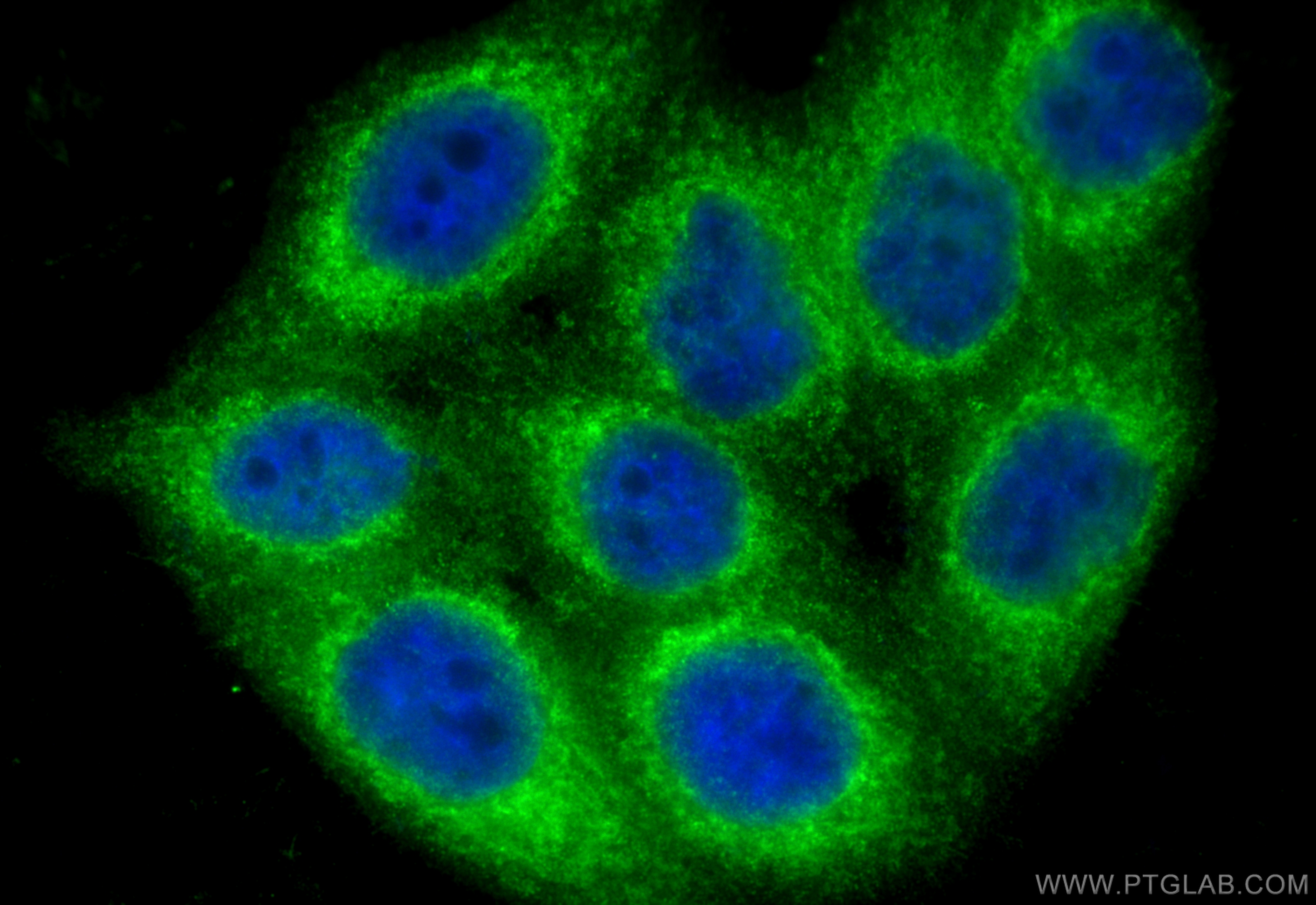 Immunofluorescence (IF) / fluorescent staining of HepG2 cells using RHBDF2 Polyclonal antibody (23181-1-AP)