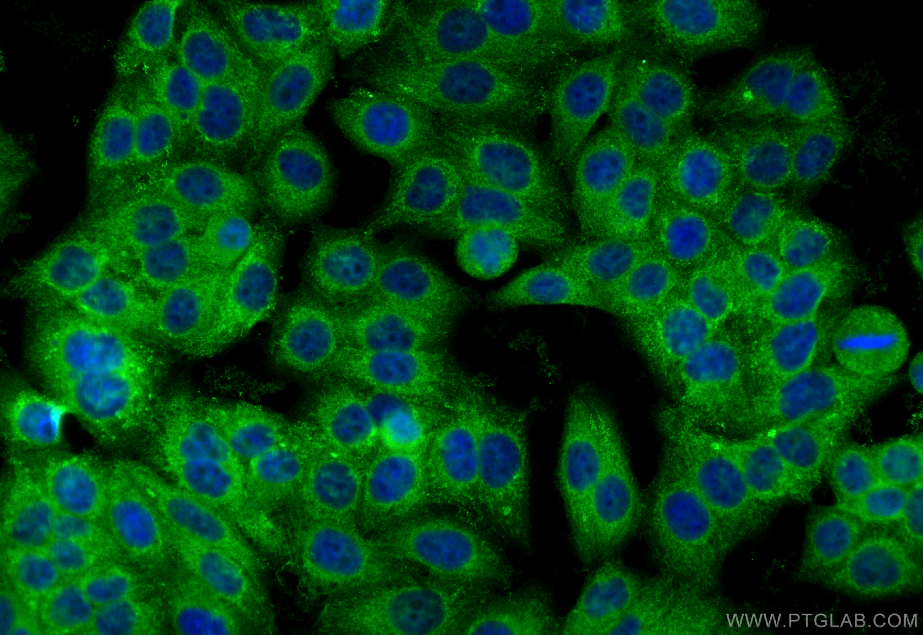 Immunofluorescence (IF) / fluorescent staining of HepG2 cells using RHBDF2 Polyclonal antibody (23181-1-AP)