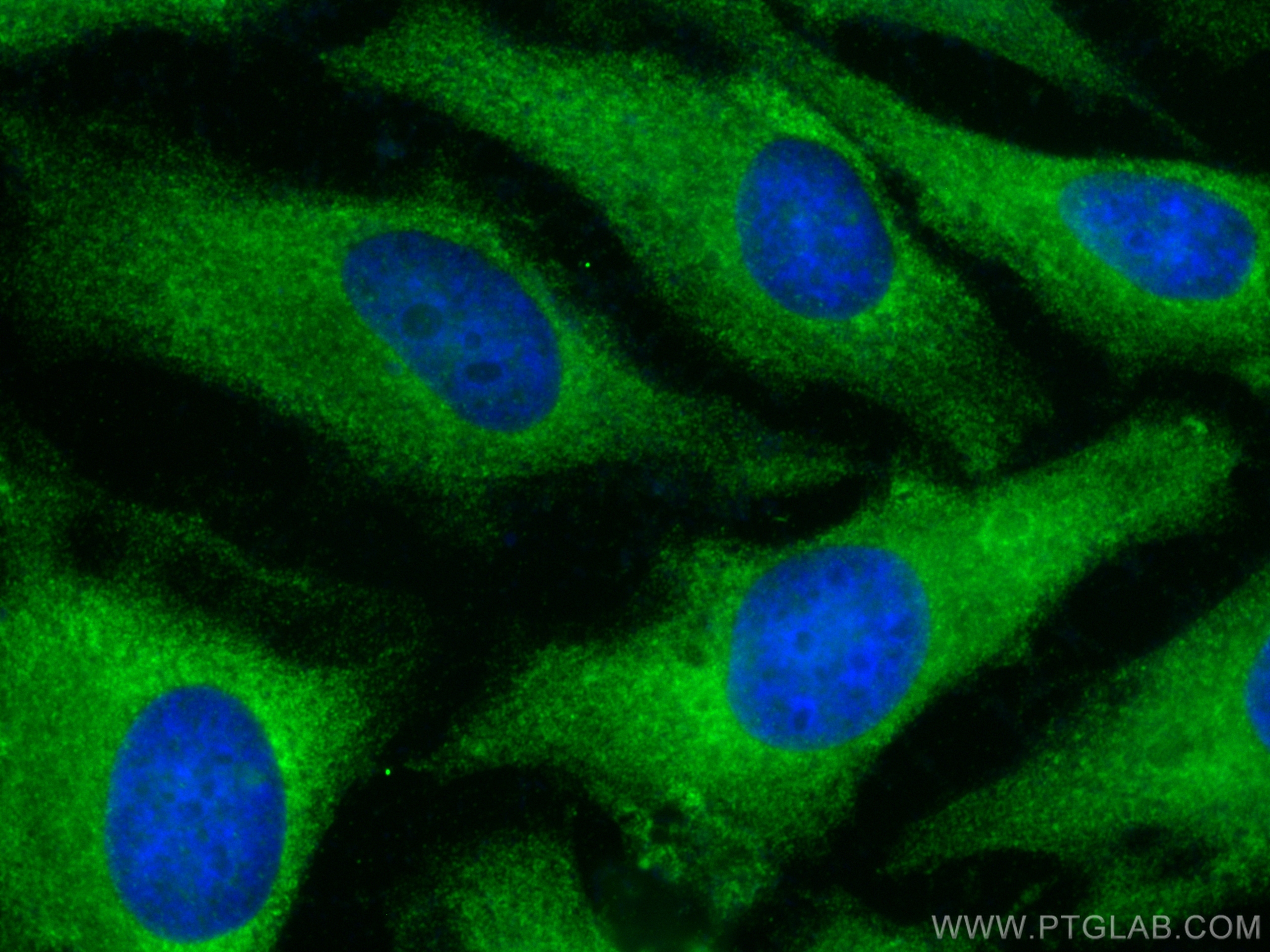 Immunofluorescence (IF) / fluorescent staining of HeLa cells using RHOA Polyclonal antibody (10749-1-AP)