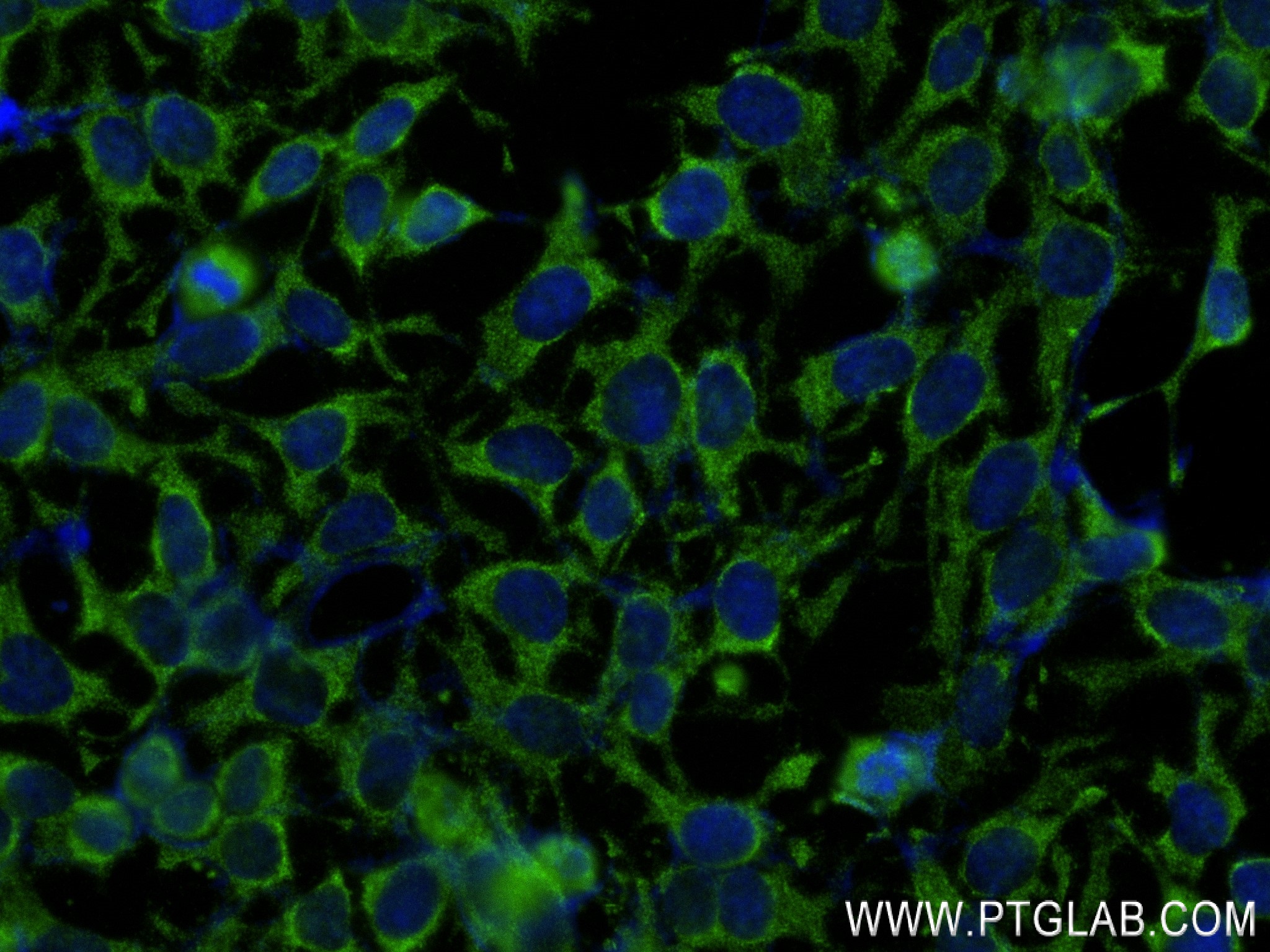 Immunofluorescence (IF) / fluorescent staining of HeLa cells using RHOA Recombinant antibody (82760-2-RR)